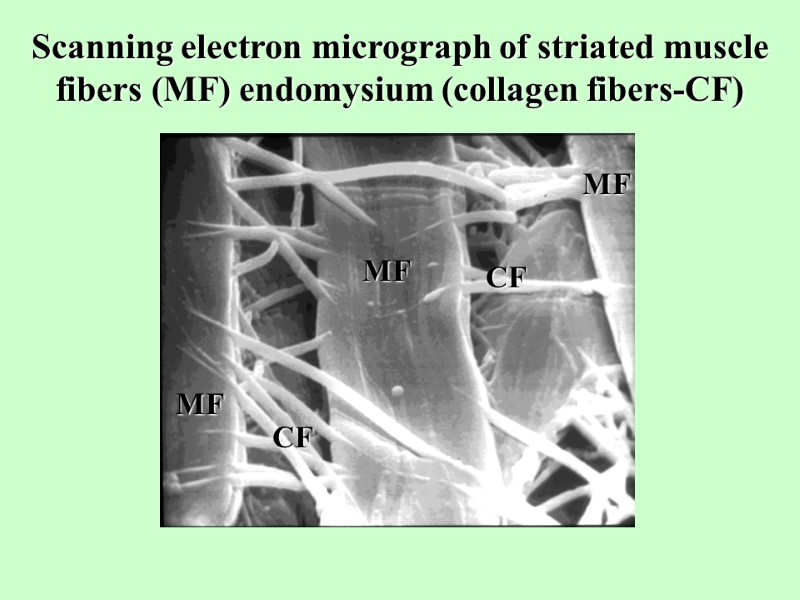 Scanning electron micrograph of striated muscle fibers (MF) endomysium (collagen fibers-СF)